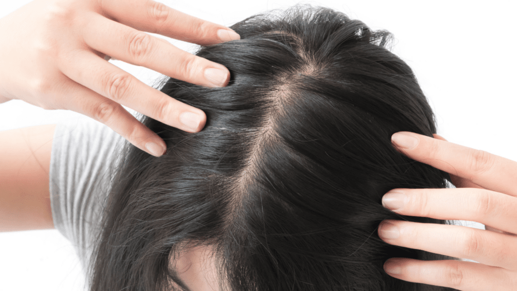 A trichologist gives answers as to why the hair does not grow and fall out